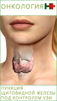 Пункция щитовидной железы под контролем УЗИ